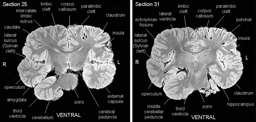 Killer Whale Brain