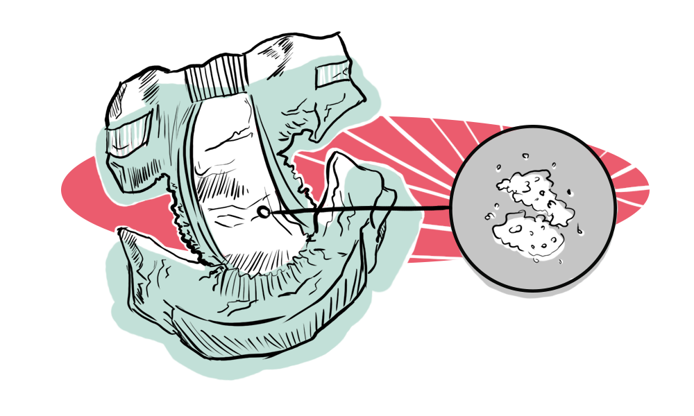 Swell! Expansion Microscopy