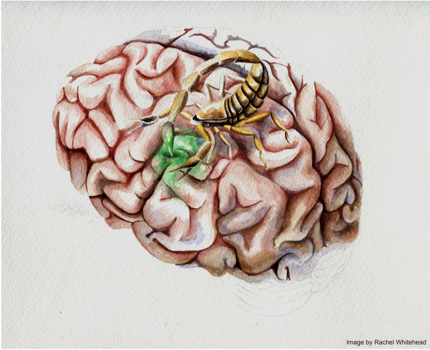 Testing Tumor Paint: Current Clinical Trials