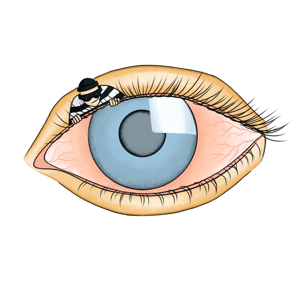 Glaucoma: The Silent Thief
